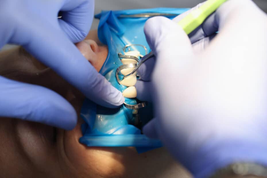 doctor dentist fixing veneer patient teeth using metal tools closeup
