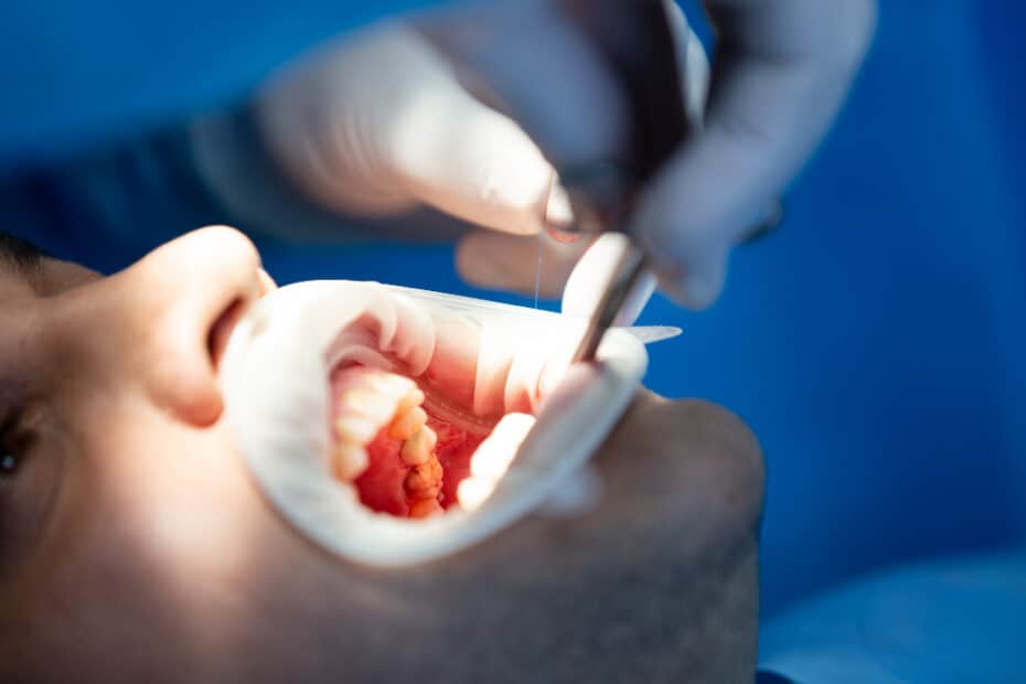 pacient dental clinic while operation