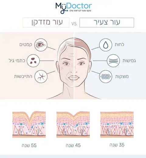 אינפוגראפיקה
